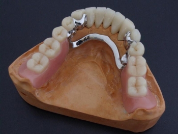 Комбинированные зубные протезы цена