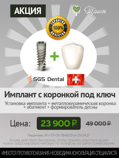 Имплантация зубов Швейцария цена