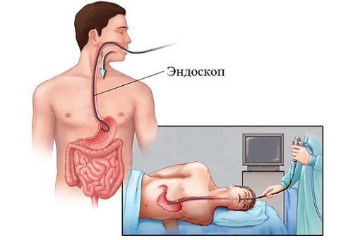 Гастроскопия желудка цена в Москве